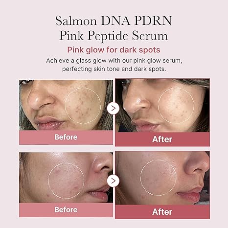 medicube Salmon DNA PDRN Pink Peptide Serum, Pink glow serum, Peptide, Niacinamide, Hydrating & Moisturizing & Firming, Uneven Skin Tone, Korean Skincare | 1.01 fl.oz. (1.01 fl.oz., Salmon DNA PDRN), Korean Glass Skin