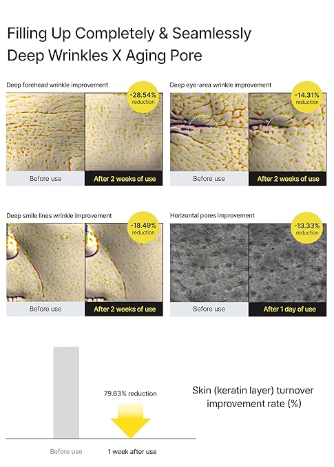 celimax The Vita A Retinal Shot Tightening Booster | Pore Minimizer, Wrinkles & Fine Lines, Firmer Skin, 15ml, Made In Korean